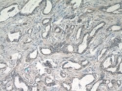 JUN Rabbit anti-Hamster, Human, Mouse, Polyclonal, Proteintech 150 &mu;L;