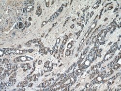 JUN Rabbit anti-Hamster, Human, Mouse, Polyclonal, Proteintech 150 &mu;L;