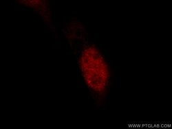 JUN Rabbit anti-Hamster, Human, Mouse, Polyclonal, Proteintech 150 &mu;L;