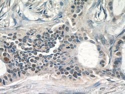 JUN Rabbit anti-Hamster, Human, Mouse, Polyclonal, Proteintech 150 &mu;L;