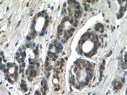 JUN Rabbit anti-Hamster, Human, Mouse, Polyclonal, Proteintech 150 &mu;L;