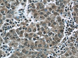 HDAC10 Rabbit anti-Human, Mouse, Rat, Polyclonal, Proteintech 150 &mu;L;