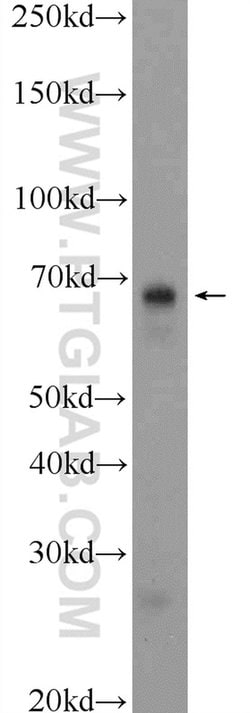 HDAC10 Rabbit anti-Human, Mouse, Rat, Polyclonal, Proteintech 150 &mu;L;