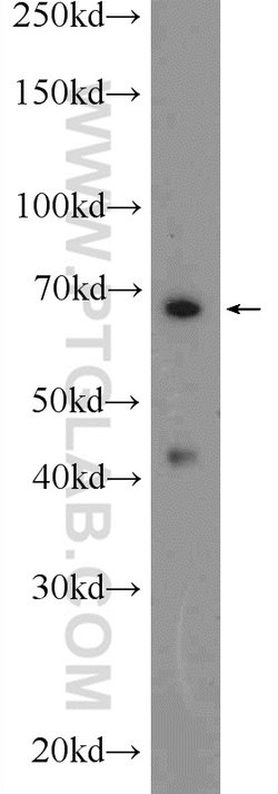 HDAC10 Rabbit anti-Human, Mouse, Rat, Polyclonal, Proteintech 150 &mu;L;
