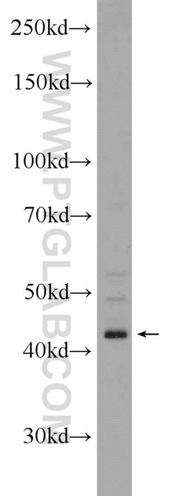 ST8SIA1 Rabbit anti-Human, Mouse, Polyclonal, Proteintech 150 &mu;L; Unconjugated:Antibodies,