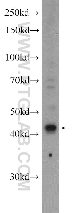 ST8SIA1 Rabbit anti-Human, Mouse, Polyclonal, Proteintech 150 &mu;L; Unconjugated:Antibodies,