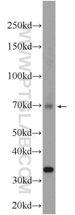 DHX35 Rabbit anti-Human, Mouse, Polyclonal, Proteintech:Antibodies:Primary