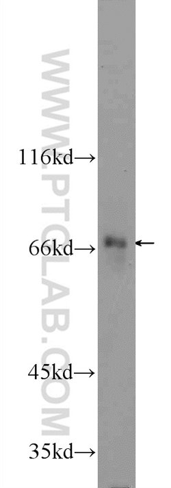 DHX35 Rabbit anti-Human, Mouse, Polyclonal, Proteintech:Antibodies:Primary