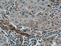 FAM155A Rabbit anti-Human, Polyclonal, Proteintech 150 &mu;L; Unconjugated:Antibodies,