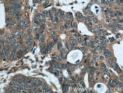 FAM155A Rabbit anti-Human, Polyclonal, Proteintech 150 &mu;L; Unconjugated:Antibodies,