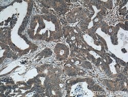 FAM155A Rabbit anti-Human, Polyclonal, Proteintech 150 &mu;L; Unconjugated:Antibodies,