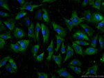 Thumbnail_ADAMTS12 Rabbit anti-Human, Mouse, Polyclonal, Proteintech 20 &mu;L; Unconjugated:Antibodies,