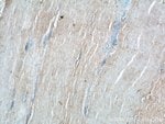 Thumbnail_ADAMTS12 Rabbit anti-Human, Mouse, Polyclonal, Proteintech 20 &mu;L; Unconjugated:Antibodies,