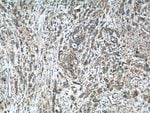 Thumbnail_ADAMTS12 Rabbit anti-Human, Mouse, Polyclonal, Proteintech 20 &mu;L; Unconjugated:Antibodies,