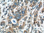 Thumbnail_ADAMTS12 Rabbit anti-Human, Mouse, Polyclonal, Proteintech 20 &mu;L; Unconjugated:Antibodies,