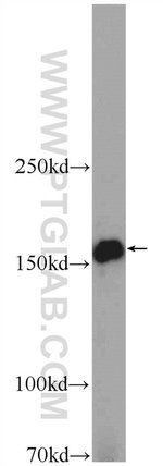 Thumbnail_ADAMTS12 Rabbit anti-Human, Mouse, Polyclonal, Proteintech 20 &mu;L; Unconjugated:Antibodies,