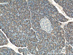 CTRB1 Rabbit anti-Human, Rat, Polyclonal, Proteintech