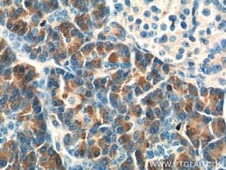 CTRB1 Rabbit anti-Human, Rat, Polyclonal, Proteintech:Anticorps:Anticorps