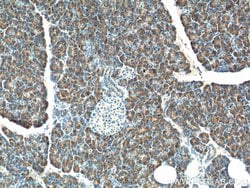 CTRB1 Rabbit anti-Human, Rat, Polyclonal, Proteintech:Anticorps:Anticorps
