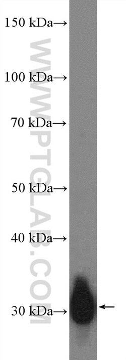 CTRB1 Rabbit anti-Human, Rat, Polyclonal, Proteintech:Anticorps:Anticorps