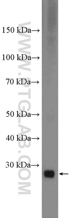 CTRB1 Rabbit anti-Human, Rat, Polyclonal, Proteintech:Anticorps:Anticorps