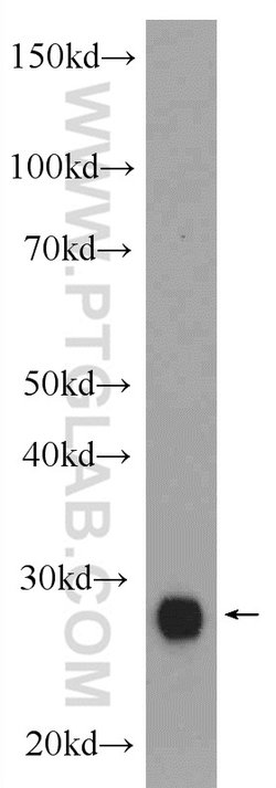 CTRB1 Rabbit anti-Human, Rat, Polyclonal, Proteintech:Anticorps:Anticorps
