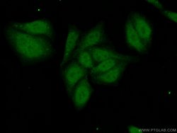 PRPF38A Rabbit anti-Human, Polyclonal, Proteintech:Anticorps:Anticorps