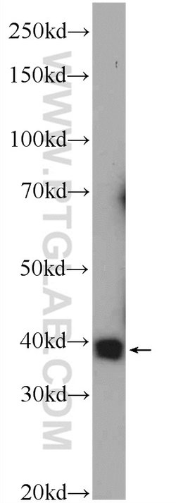 PRPF38A Rabbit anti-Human, Polyclonal, Proteintech:Anticorps:Anticorps