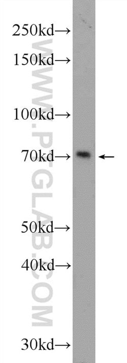 HIC1 Rabbit anti-Human, Mouse, Polyclonal, Proteintech 150 &mu;L; Unconjugated:Antibodies,