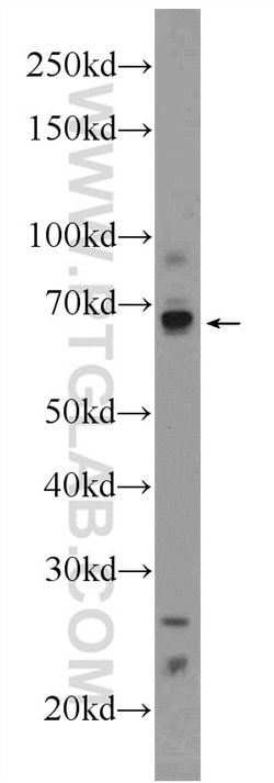 HIC1 Rabbit anti-Human, Mouse, Polyclonal, Proteintech 150 &mu;L; Unconjugated:Antibodies,