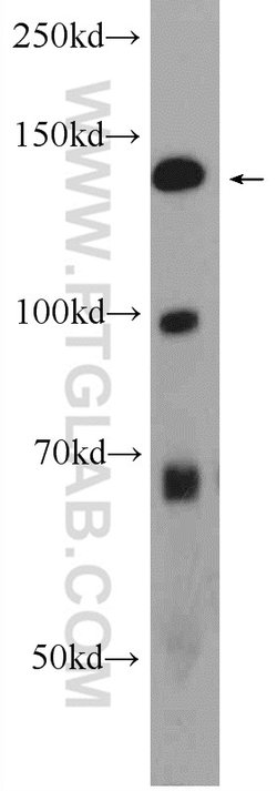 ATAD5 Rabbit anti-Human, Polyclonal, Proteintech 150 &mu;L; Unconjugated:Antibodies,