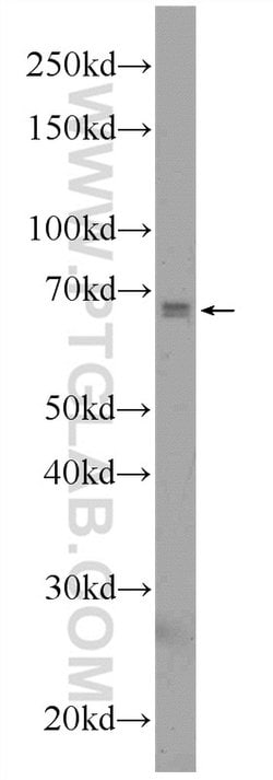 C6orf182 Rabbit anti-Human, Mouse, Non-human primate, Polyclonal, Proteintech