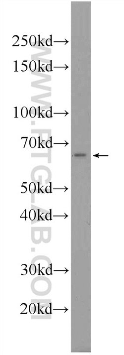 C6orf182 Rabbit anti-Human, Mouse, Non-human primate, Polyclonal, Proteintech