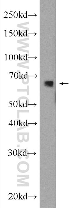 C6orf182 Rabbit anti-Human, Mouse, Non-human primate, Polyclonal, Proteintech