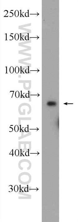 C6orf182 Rabbit anti-Human, Mouse, Non-human primate, Polyclonal, Proteintech