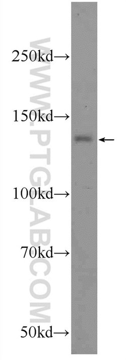 C14orf102 Rabbit anti-Human, Polyclonal, Proteintech 150 &mu;L | Buy Online | Proteintech Group Inc | Fisher Scientific