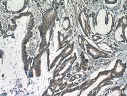 KIAA0087 Rabbit anti-Human, Polyclonal, Proteintech:Antibodies:Primary
