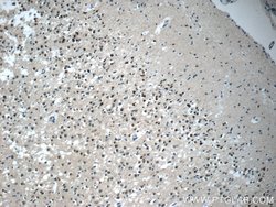 KIAA0087 Rabbit anti-Human, Polyclonal, Proteintech:Antibodies:Primary