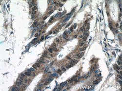 KIAA0087 Rabbit anti-Human, Polyclonal, Proteintech:Antibodies:Primary