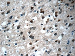 KIAA0087 Rabbit anti-Human, Polyclonal, Proteintech:Antibodies:Primary
