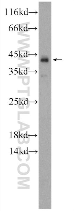 KIAA0087 Rabbit anti-Human, Polyclonal, Proteintech:Antibodies:Primary