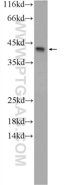 KIAA0087 Rabbit anti-Human, Polyclonal, Proteintech:Antibodies:Primary