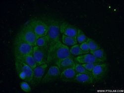 C18orf21 Rabbit anti-Human, Polyclonal, Proteintech:Antibodies:Primary