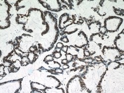 C18orf21 Rabbit anti-Human, Polyclonal, Proteintech:Antibodies:Primary