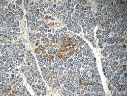 C18orf21 Rabbit anti-Human, Polyclonal, Proteintech:Antibodies:Primary