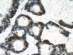 C18orf21 Rabbit anti-Human, Polyclonal, Proteintech:Antibodies:Primary