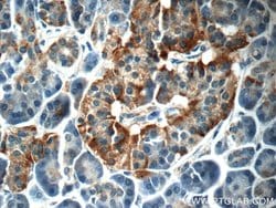 C18orf21 Rabbit anti-Human, Polyclonal, Proteintech:Antibodies:Primary