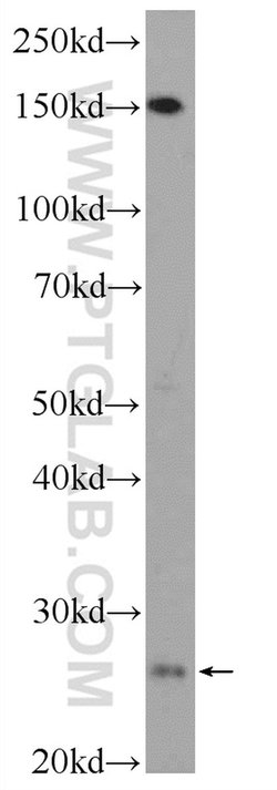 C18orf21 Rabbit anti-Human, Polyclonal, Proteintech:Antibodies:Primary