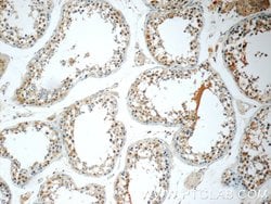FDXACB1 Rabbit anti-Human, Polyclonal, Proteintech 150 &mu;L | Buy Online | Proteintech Group Inc | Fisher Scientific