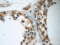 FDXACB1 Rabbit anti-Human, Polyclonal, Proteintech 150 &mu;L | Buy Online | Proteintech Group Inc | Fisher Scientific